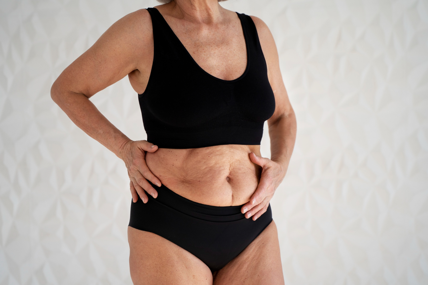 La ciencia detrás del Mommy Makeover