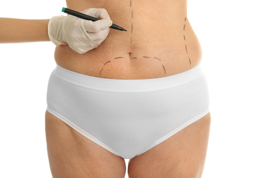 Expectativas realistas vs. resultados de cirugía estética ¡no te compares!