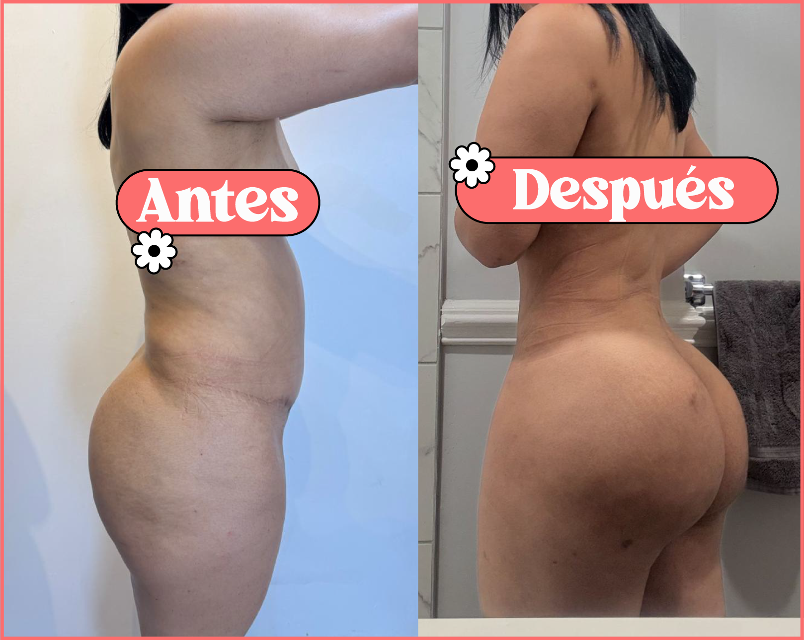 Antes y después: un resultado hermoso de BBL